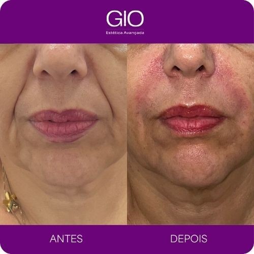 Preeenchimento bigode chinês